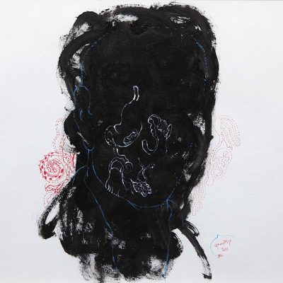 Patient-Jagath
