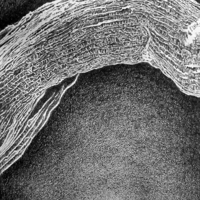 The-Spine-Series-Bridge-Parvathi-Nayar